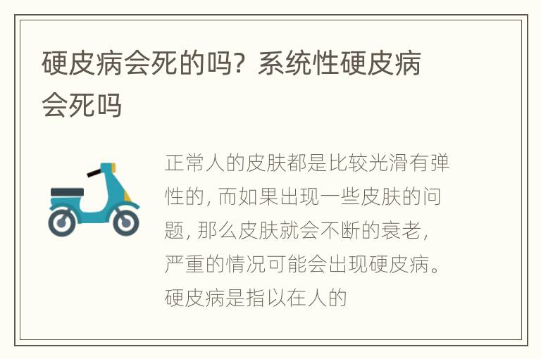 硬皮病会死的吗？ 系统性硬皮病会死吗