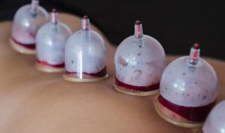 拔罐和刮痧哪个去湿气 去湿气用拔罐还是刮痧