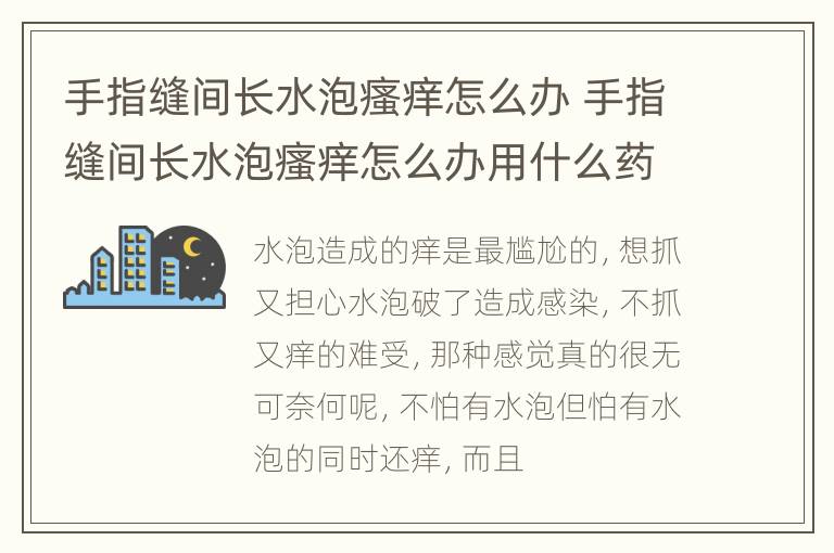 手指缝间长水泡瘙痒怎么办 手指缝间长水泡瘙痒怎么办用什么药