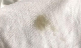 白色衣服有油清洁小妙招 白色衣服有油怎么清洁