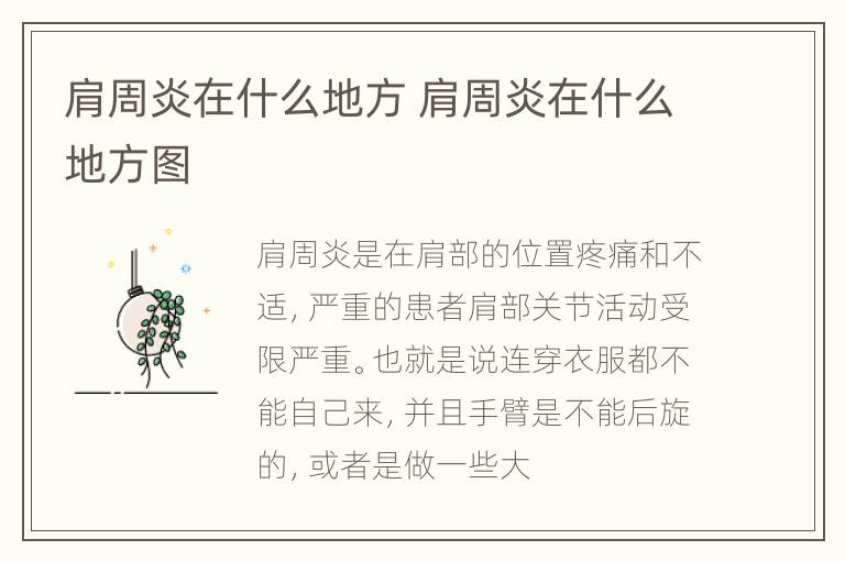 肩周炎在什么地方 肩周炎在什么地方图