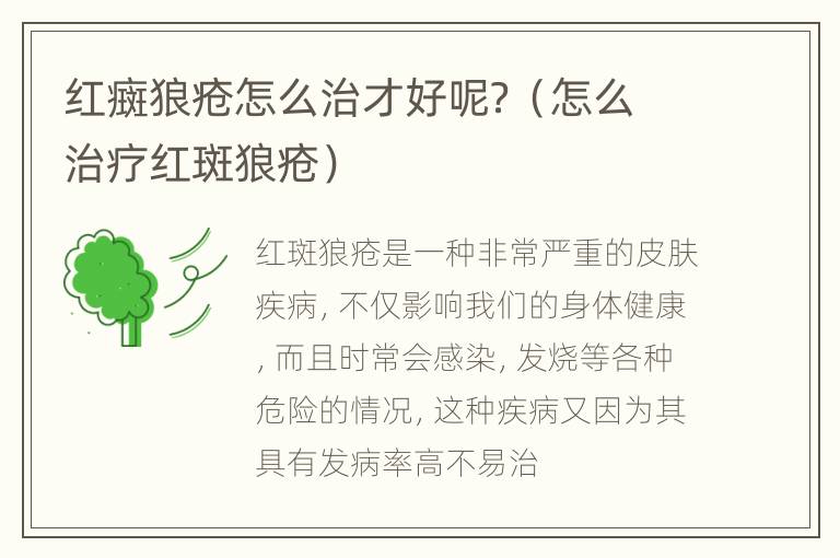 红癍狼疮怎么治才好呢？（怎么治疗红斑狼疮）