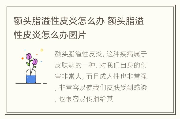 额头脂溢性皮炎怎么办 额头脂溢性皮炎怎么办图片