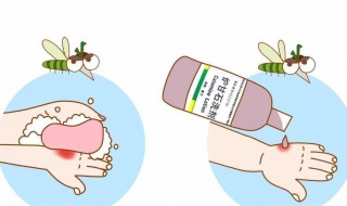 怎么防止蚊虫叮咬 防止蚊虫叮咬的方法