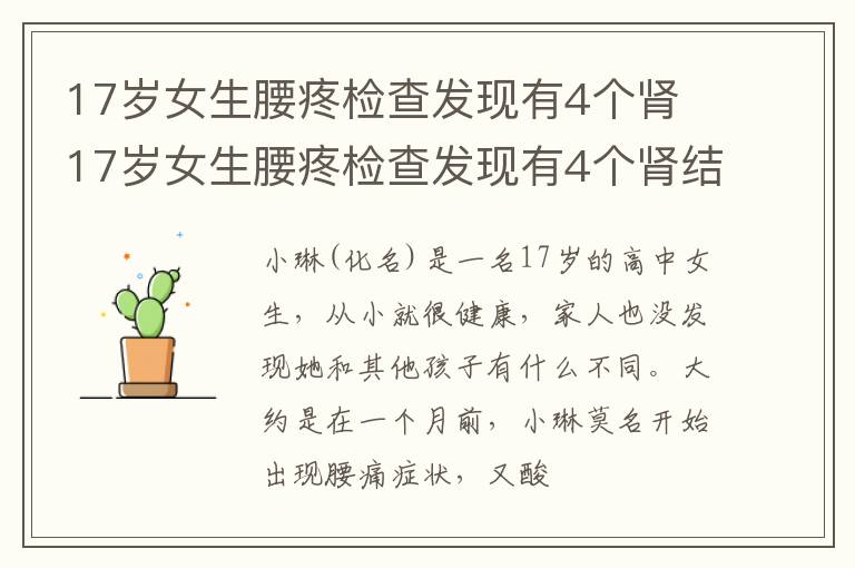 17岁女生腰疼检查发现有4个肾 17岁女生腰疼检查发现有4个肾结石