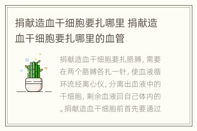 捐献造血干细胞要扎哪里 捐献造血干细胞要扎哪里的血管