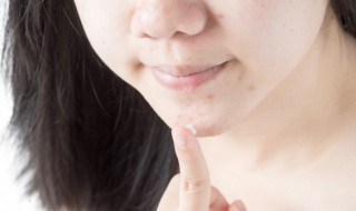 冻干粉淡化痘印要多久 冻干粉去痘印要多长时间