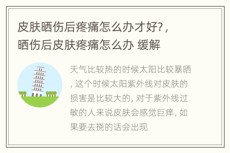 皮肤晒伤后疼痛怎么办才好？，晒伤后皮肤疼痛怎么办 缓解
