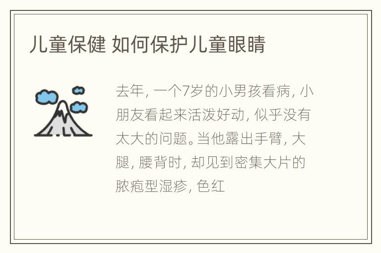 儿童保健 如何保护儿童眼睛