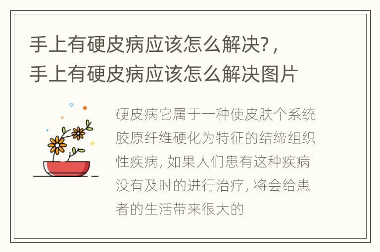 手上有硬皮病应该怎么解决？，手上有硬皮病应该怎么解决图片