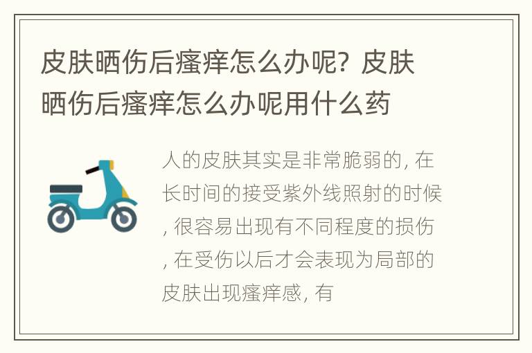 皮肤晒伤后瘙痒怎么办呢？ 皮肤晒伤后瘙痒怎么办呢用什么药